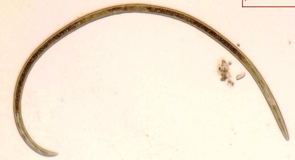 Xiphinema rivesi mature female