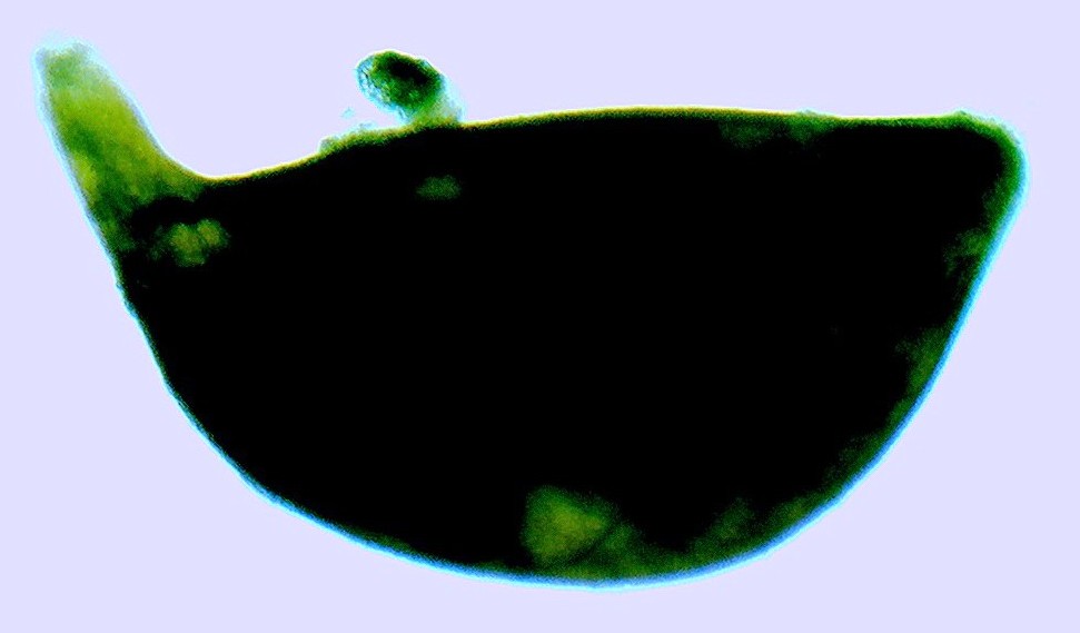 Heterodera cyst
