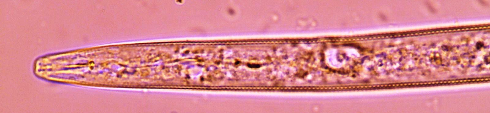 Meloidogyne naasi juvenile head