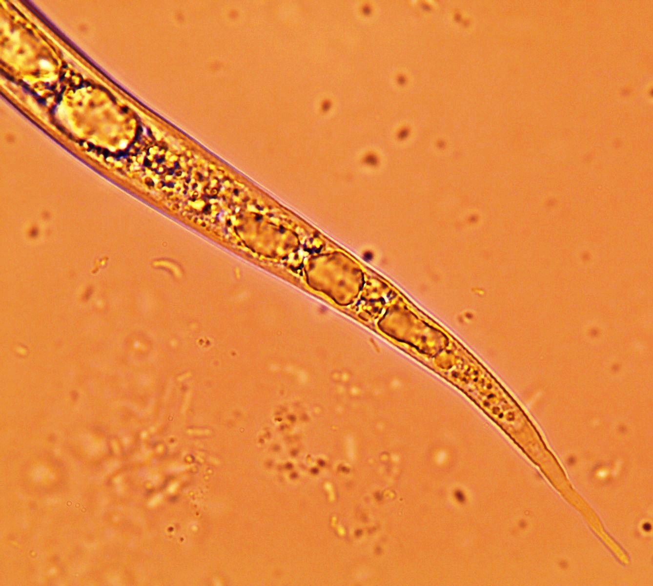 Meloidogyne naasi juvenile tail